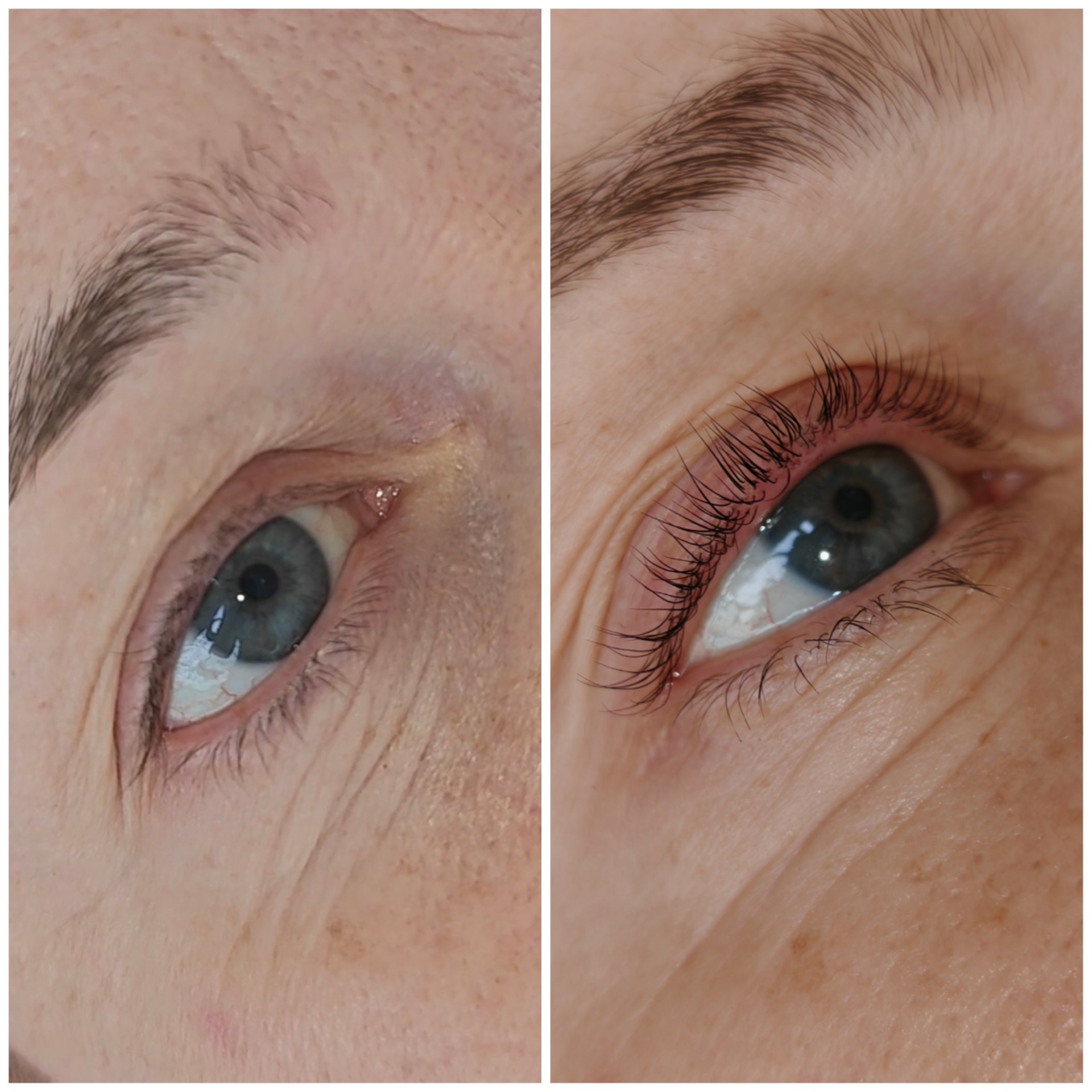 Lash lifting 